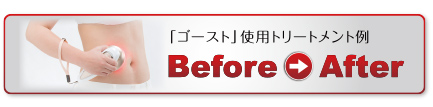beforeafter